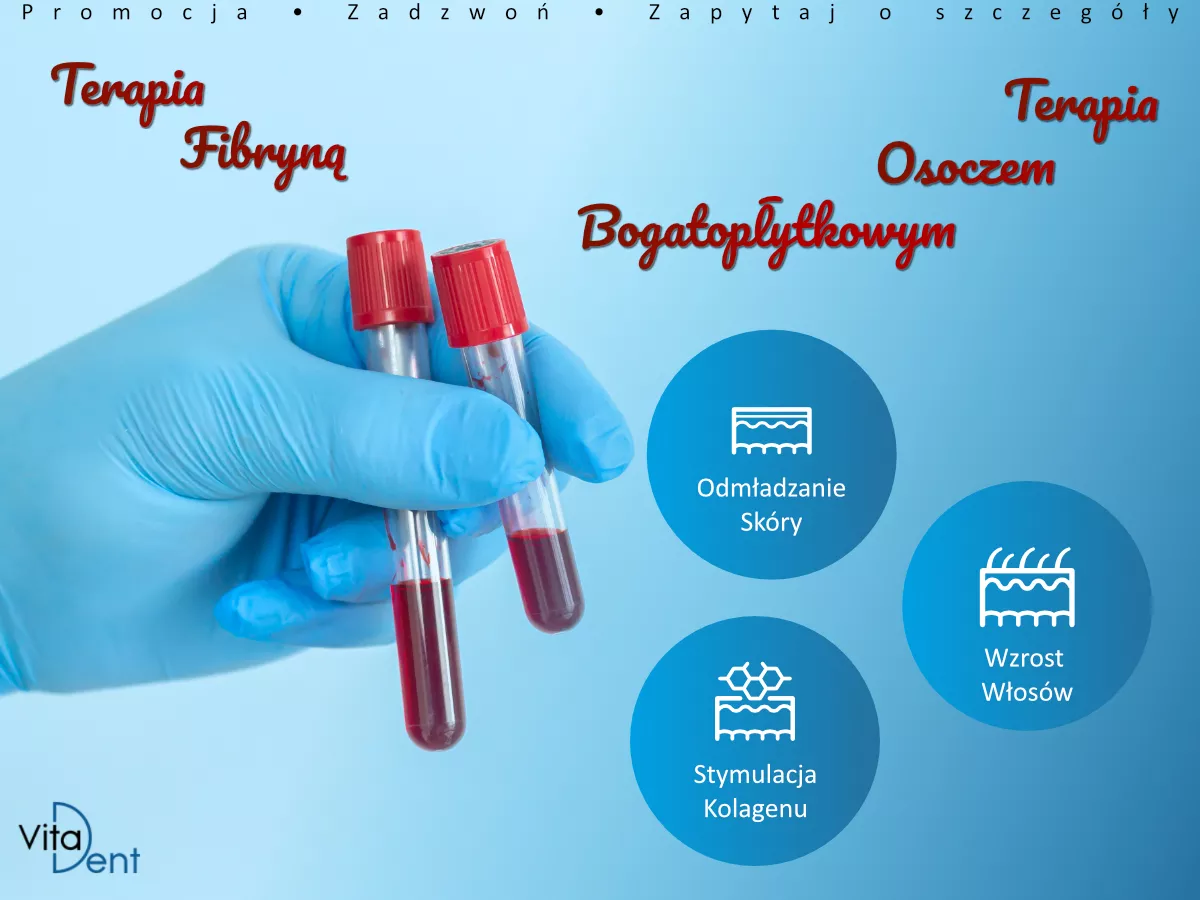 Terapia Osoczem Bogatopłytkowym